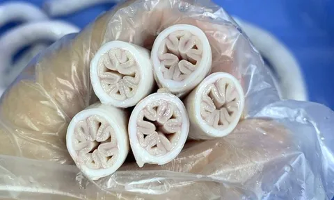 Xử phạt gần 15 triệu đồng 2 quán bán lòng heo tại Tp.HCM