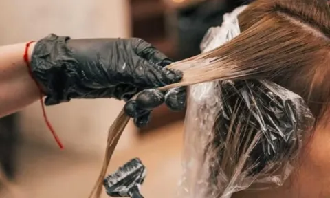 Ngạt mũi, mất khứu giác vì nghề... làm đẹp