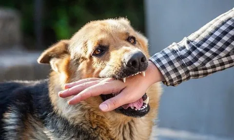 Bé trai ở Đắk Lắk bị chó cắn nhiều lần nhưng không tiêm phòng, tử vong nghi do bệnh dại