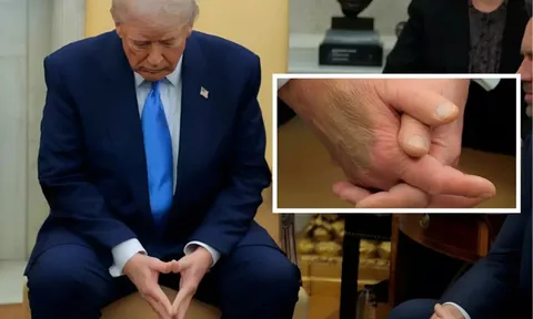 Bàn tay của ông Trump bất ngờ thu hút sự chú ý