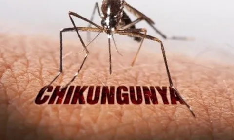 Bộ Y tế bác thông tin Việt Nam có ca mắc bệnh Chikungunya