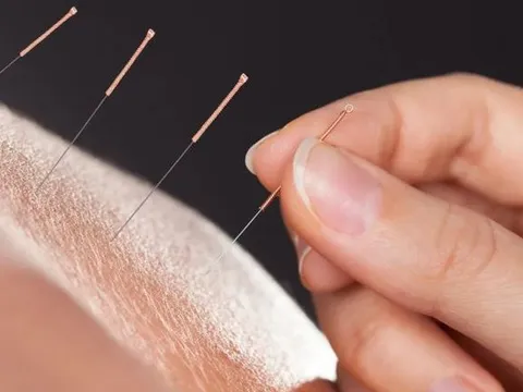 Người đàn ông 47 tuổi phải cắt một bên chân sau khi đi châm cứu