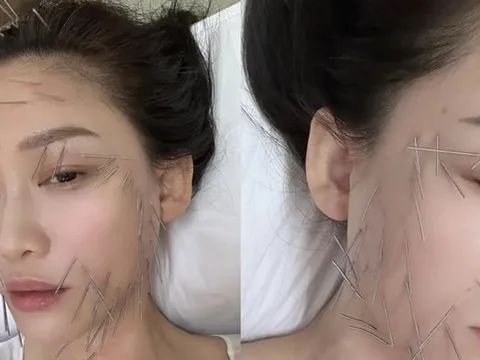 "Nữ hoàng phim thần tượng" gây sốt khi cắm hàng trăm chiếc kim khắp cơ thể