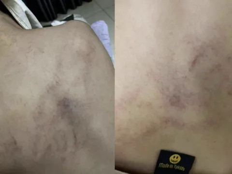 Đình chỉ cô giáo bị tố dốc ngược đầu trẻ, ném xuống giường ở Trường Mầm non Gia Thụy