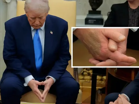 Bàn tay của ông Trump bất ngờ thu hút sự chú ý