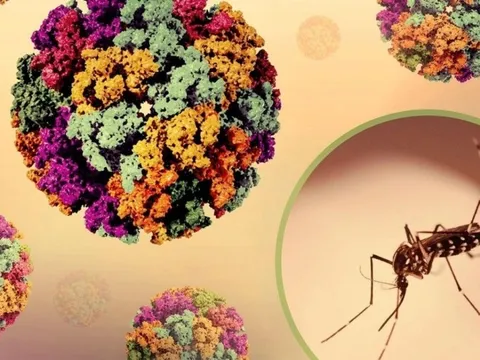 Dịch bệnh Chikungunya tăng tại nhiều nước, Bộ Y tế chỉ đạo khẩn