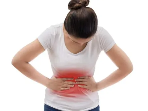 Tưởng rối loạn tiêu hóa người phụ nữ không ngờ mắc ung thư đại tràng